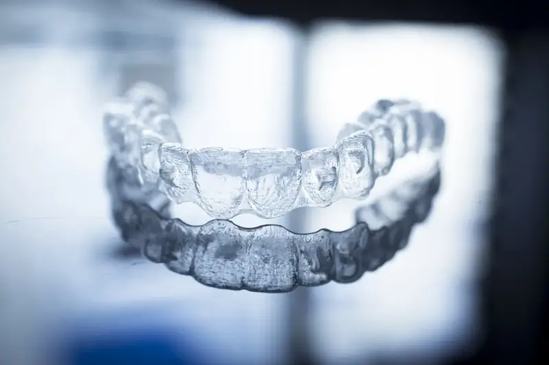 Jak długo trwa leczenie nakładkami Invisalign?