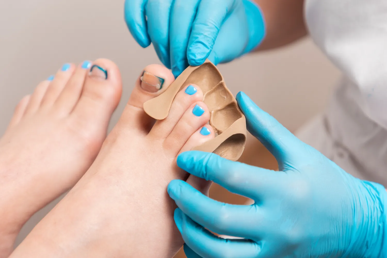 Czym jest pedicure leczniczy oraz na czym dokładnie polega?