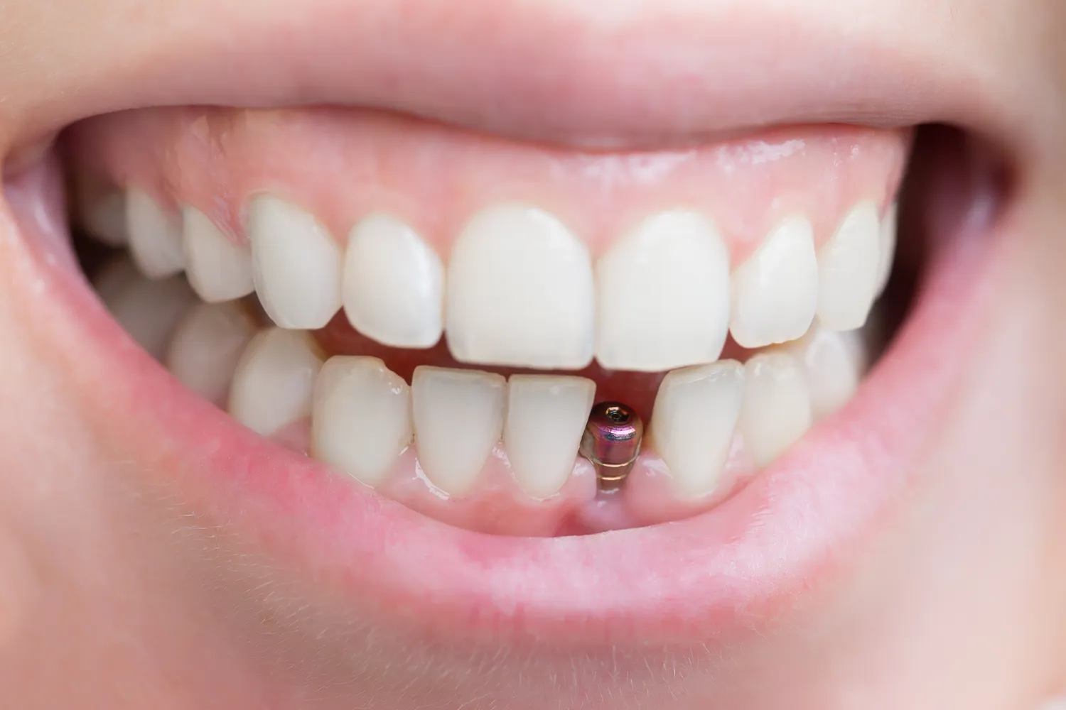 Wizyta u dentysty