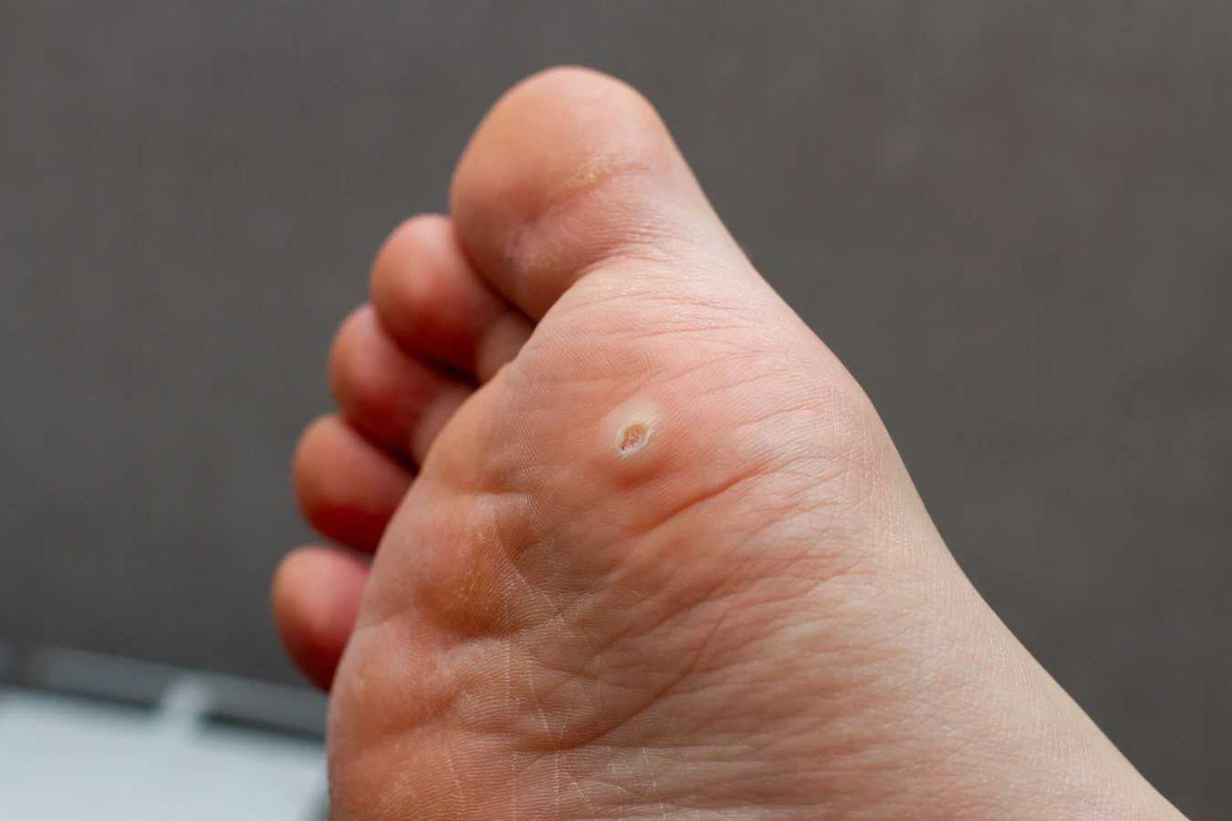 Co warto wiedzieć o leczniczym pedicure?